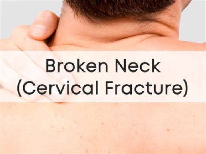 Broken neck and comparison photos