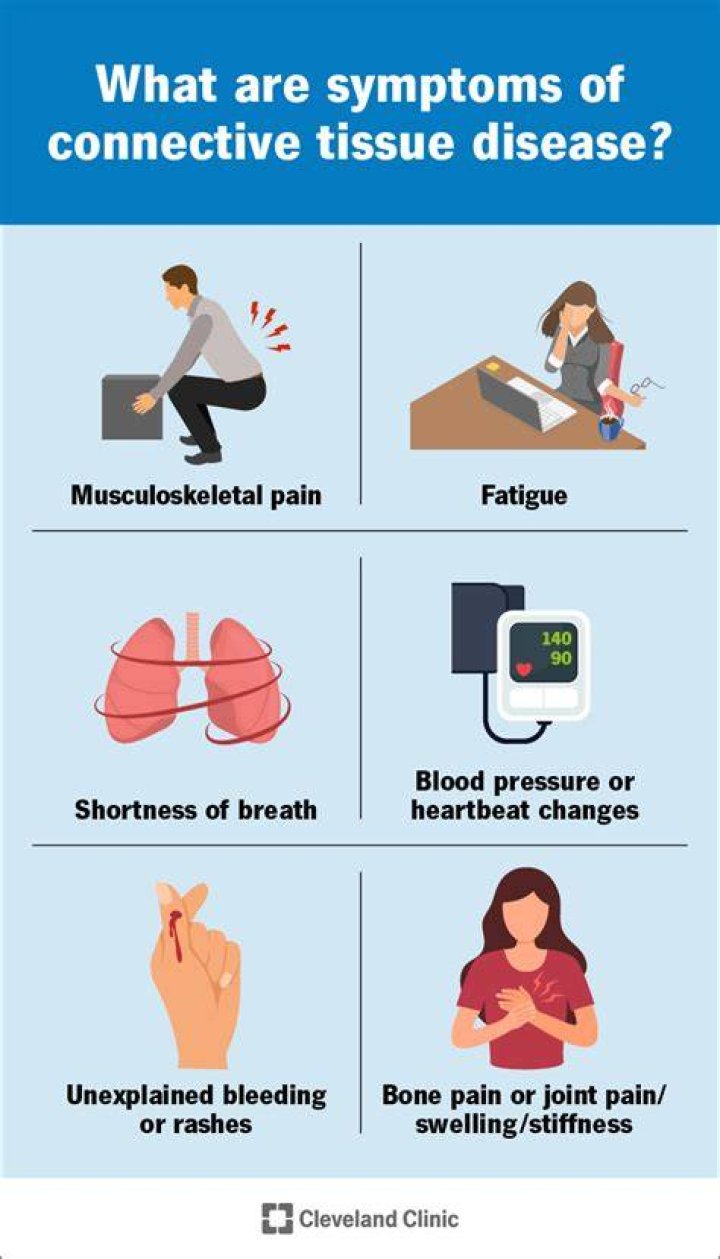 Connective Tissue Disease Increases Risk for Cardiovascular Problems