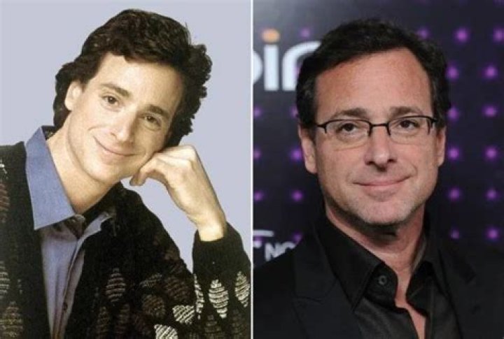Did Bob Saget have face surgery and why?
