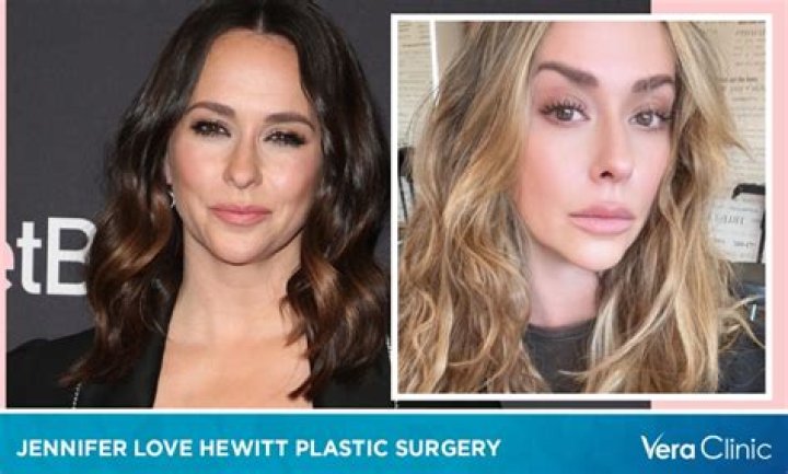 Did Jennifer Love Hewitt have plastic surgery? The new photos, explained