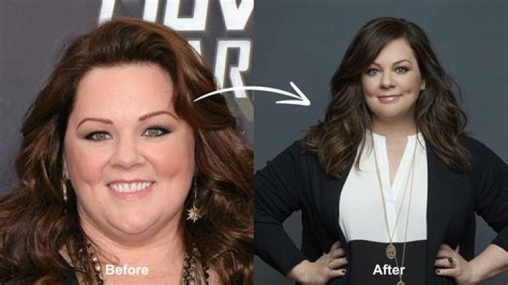 Did Melissa McCarthy have bariatric surgery? How did Melissa McCarthy lose all that weight?