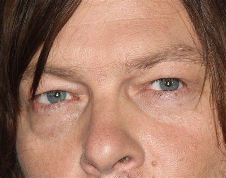 Did Norman Reedus Eye Fall Out? – Celebrity