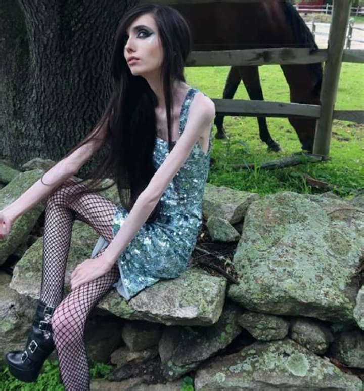 How is Eugenia Cooney still alive in 2023 after appearing skinny? How much does Eugenia Cooney weigh?