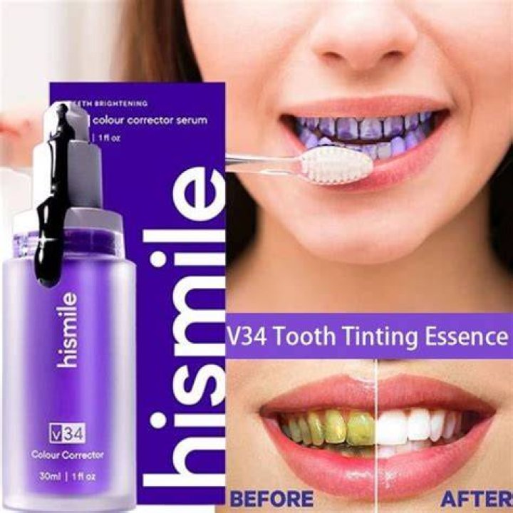 Is Hismile V34 Legit? – Celebrity