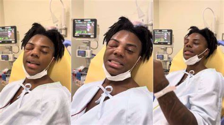 iShowSpeed in the hospital with an injured eye