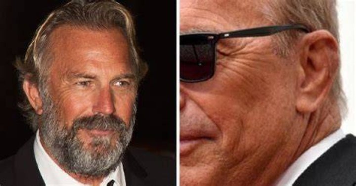 Kevin Costner ear cancer surgery