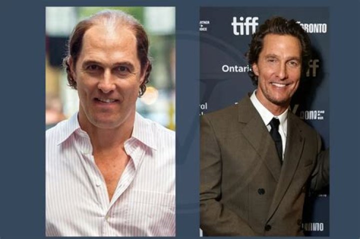 Matthew McConaughey did an odd thing to regrow his hair after nearly going bald