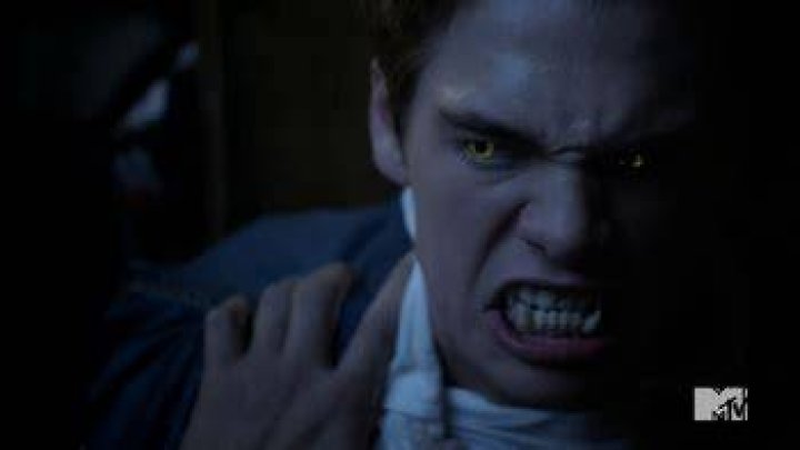 Teen Wolf Review: “The Benefactor” (Season 4, Episode 4)