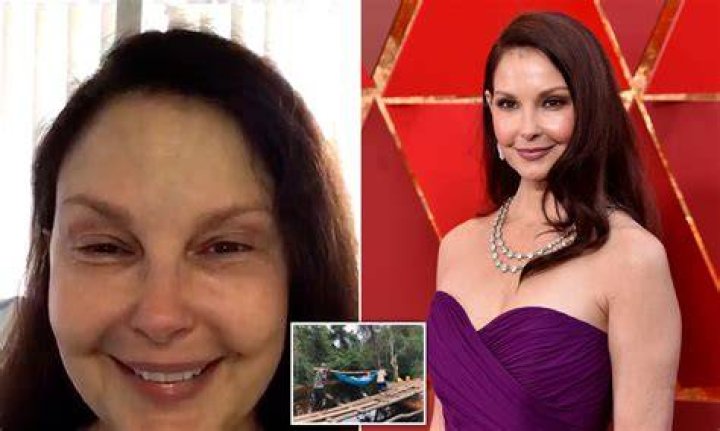 What happened to Ashley Judd's knee?