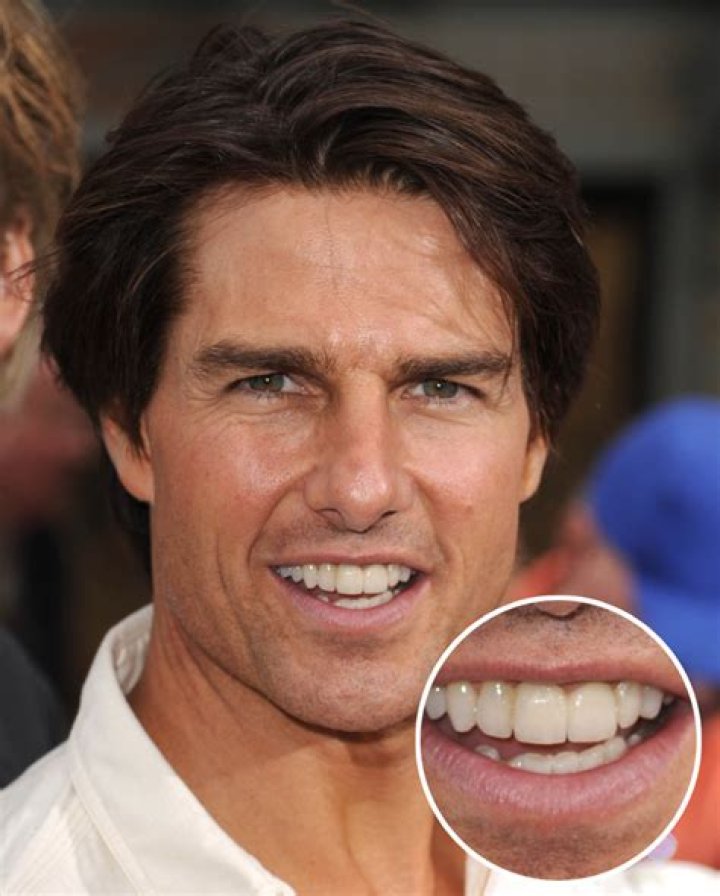 What is going on with Tom Cruise’s strange middle tooth?