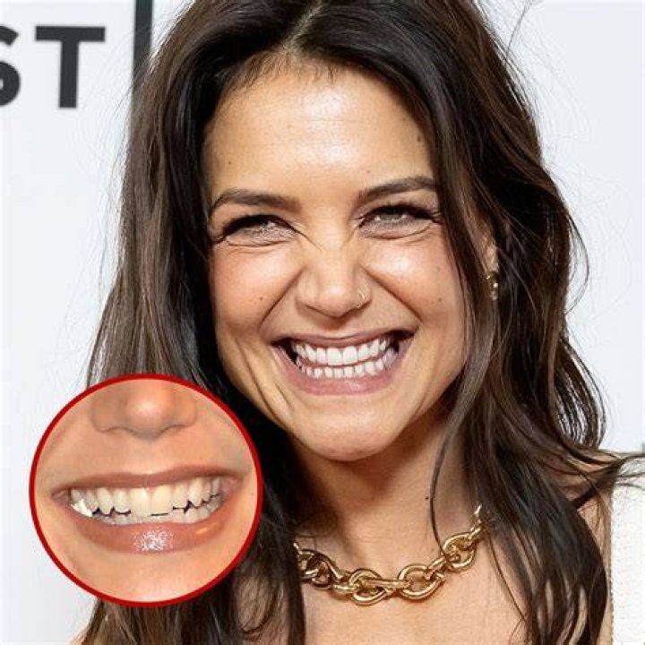 Who Did 69 Teeth? – Celebrity