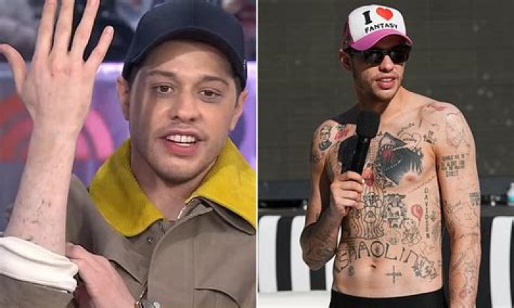 Why is Pete Davidson removing his tattoos?